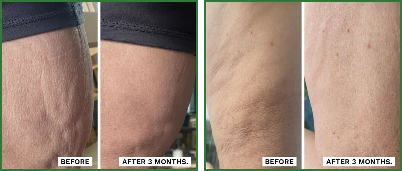 ADIPEAU Volume Cream