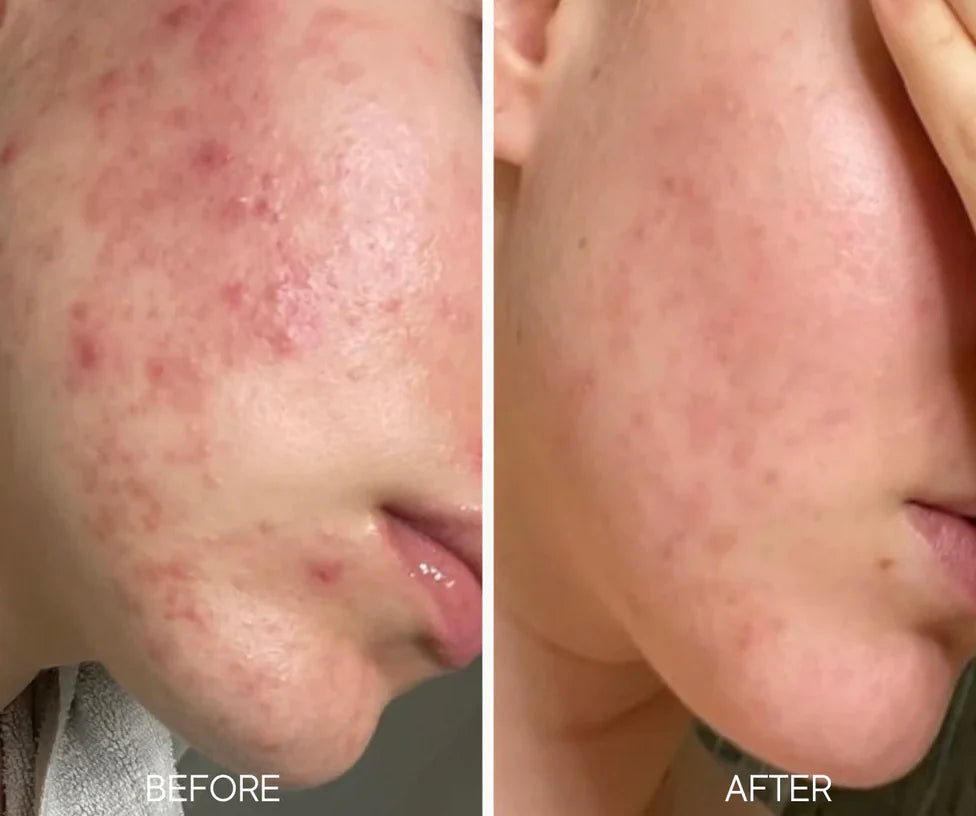 LUMIELLE GLASS SKIN LIQUID EXFOLIANT