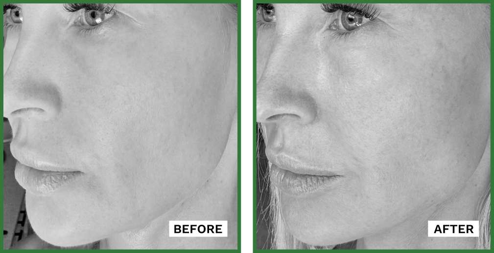 ADIPEAU Volume Cream