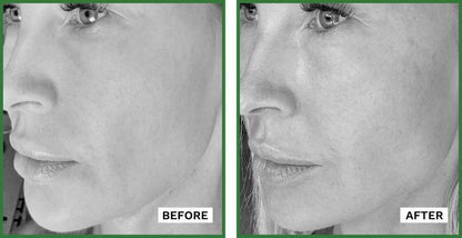 ADIPEAU Volume Cream