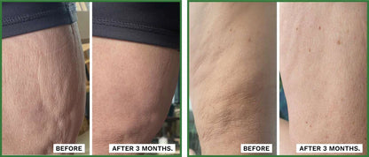 ADIPEAU Volume Cream